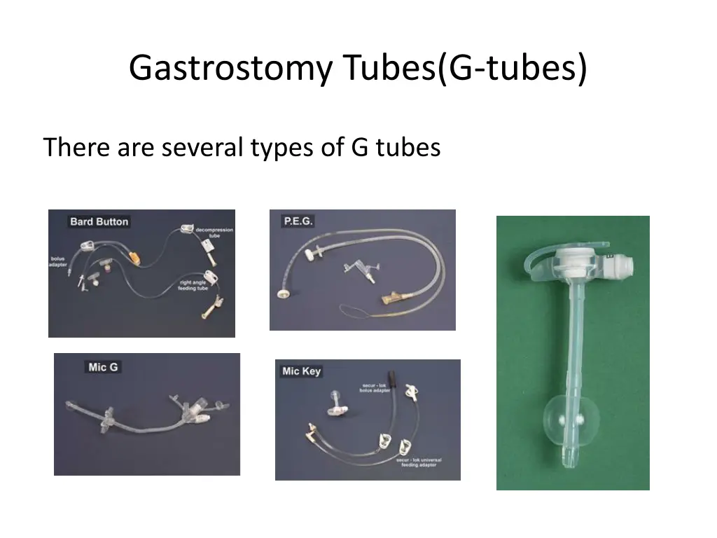 gastrostomy tubes g tubes 1