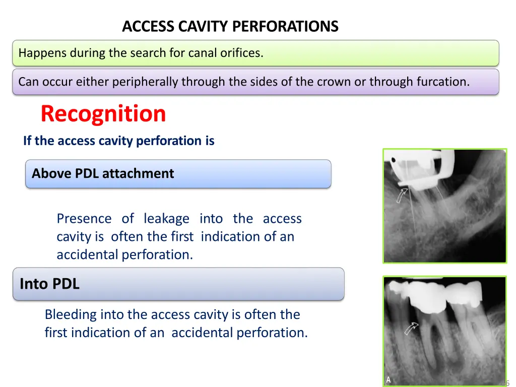 access cavity perforations