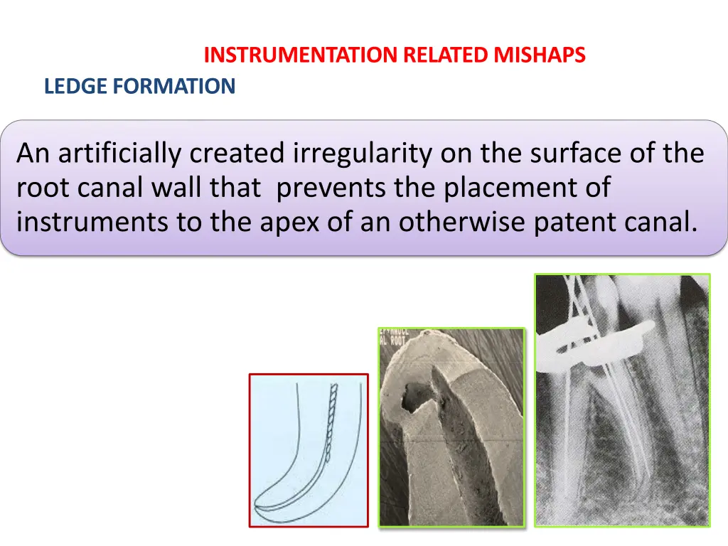 instrumentation related mishaps