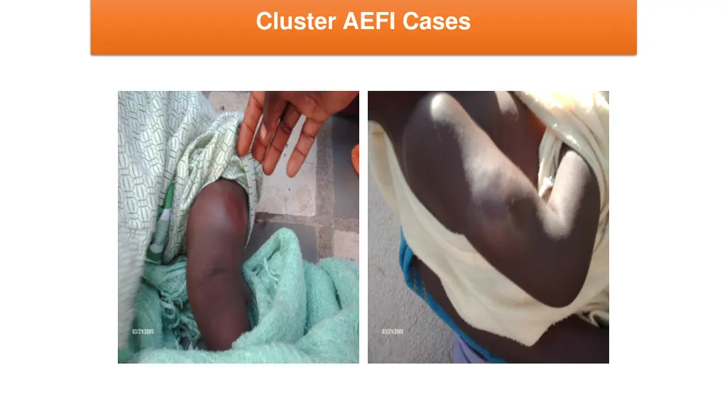 cluster aefi cases