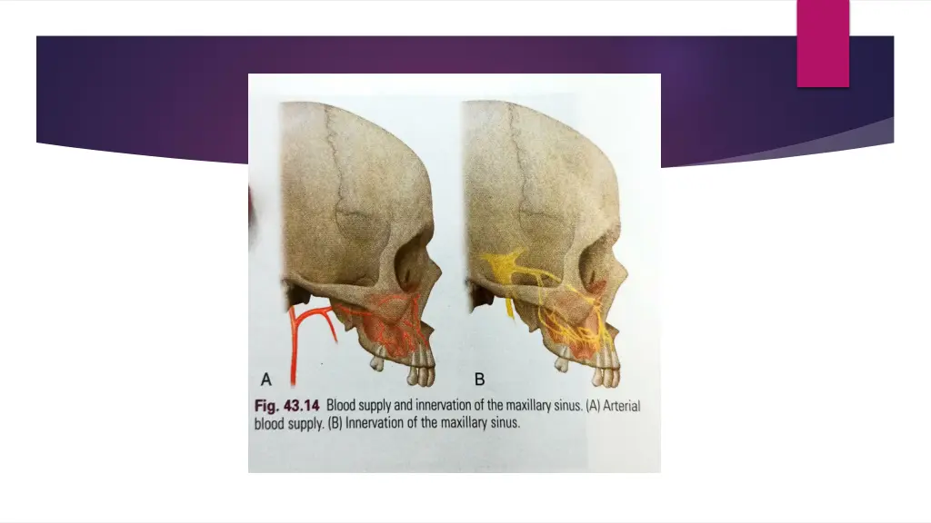 slide23