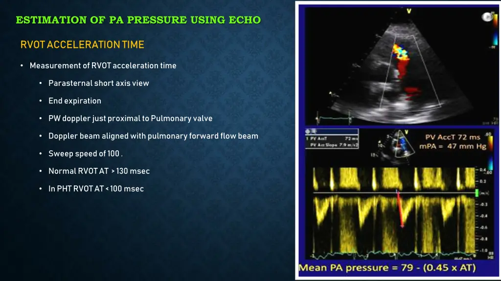 estimation of pa pressure using echo 3