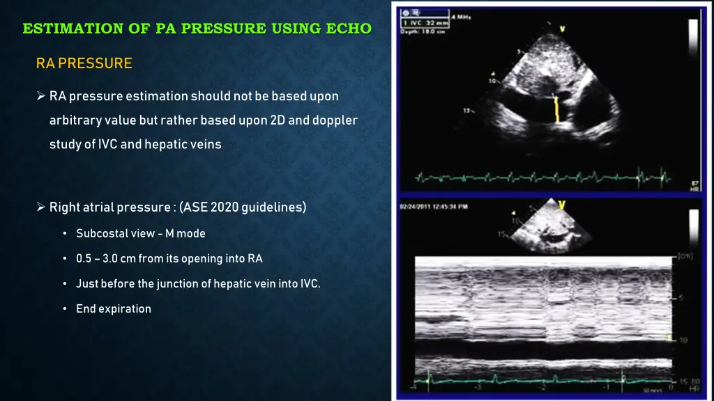 estimation of pa pressure using echo 5