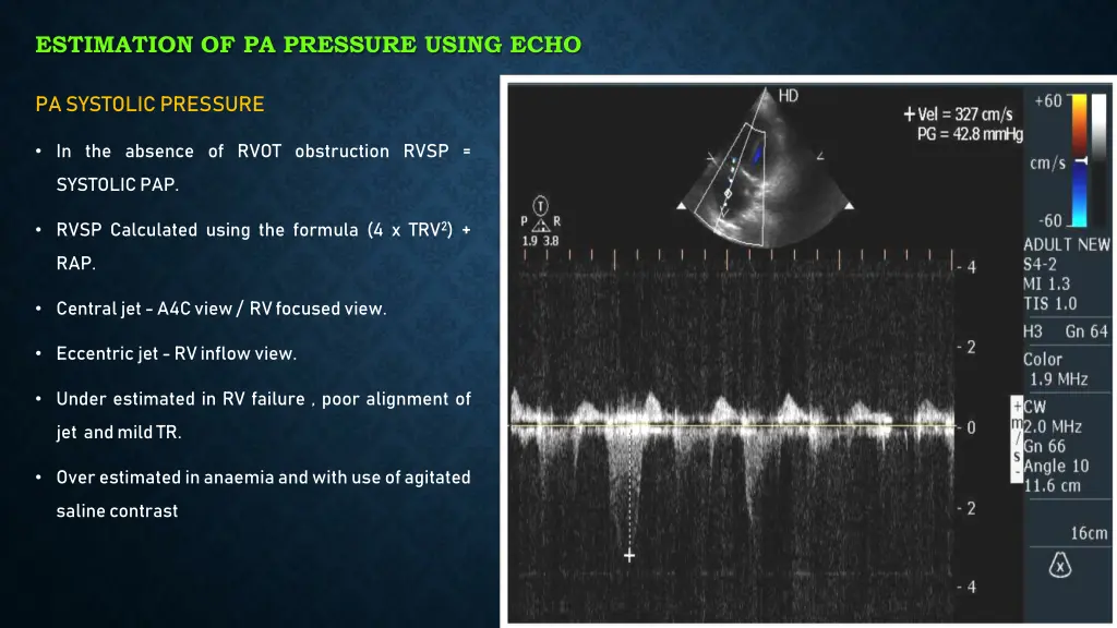 estimation of pa pressure using echo