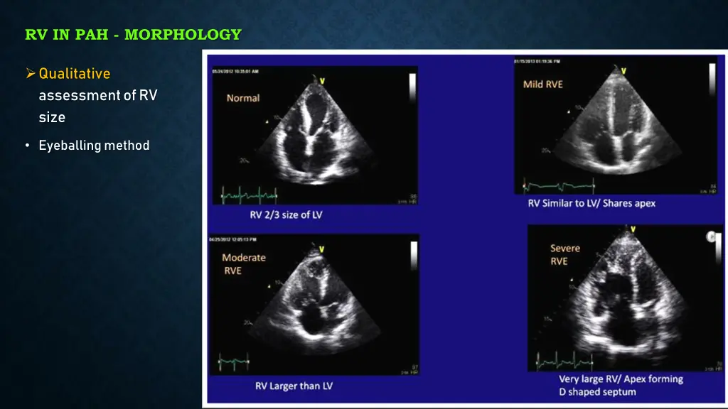 rv in pah morphology 1