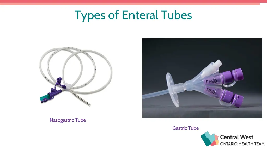 types of enteral tubes 1