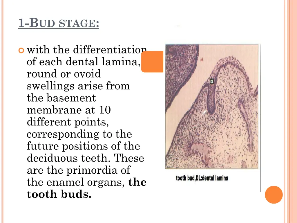 1 b ud stage