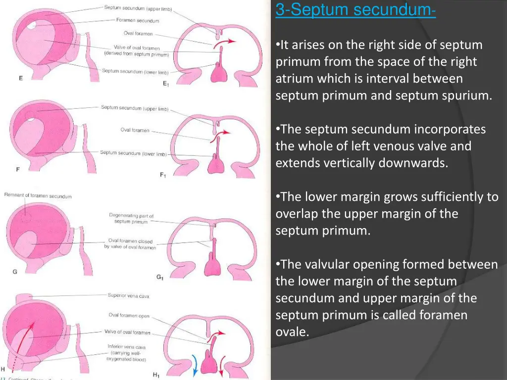 3 septum secundum