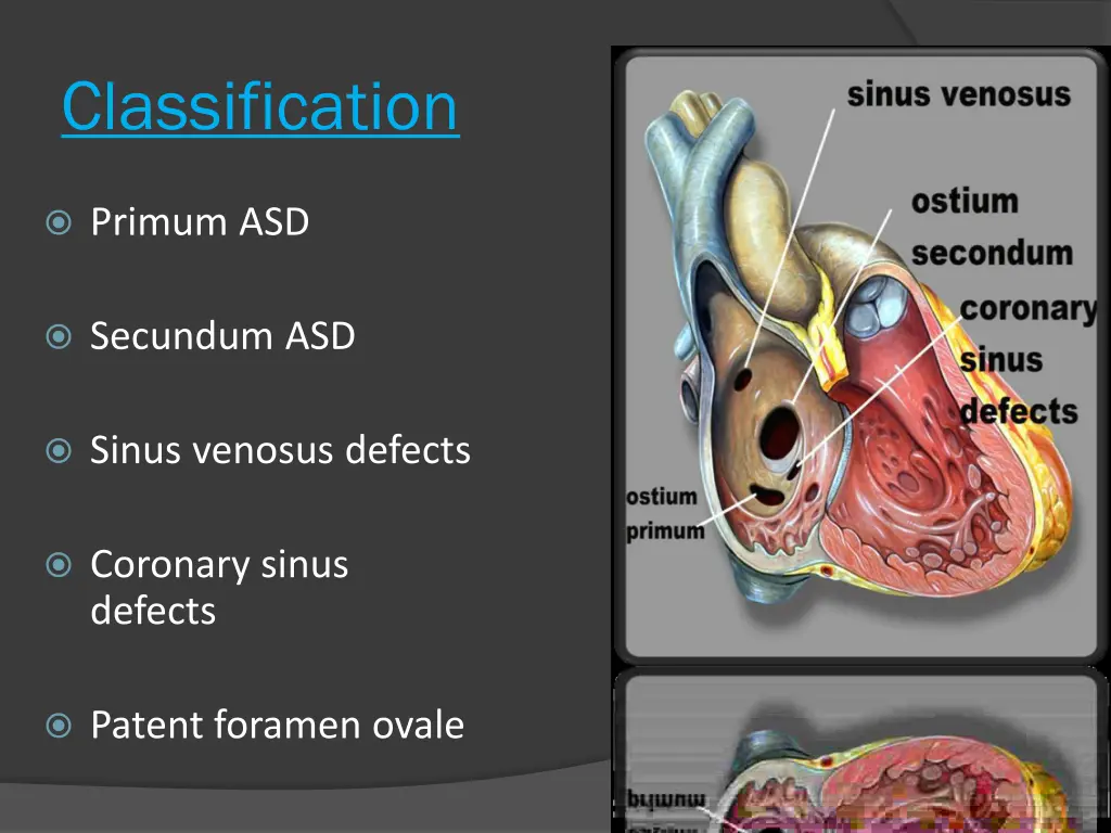 classification