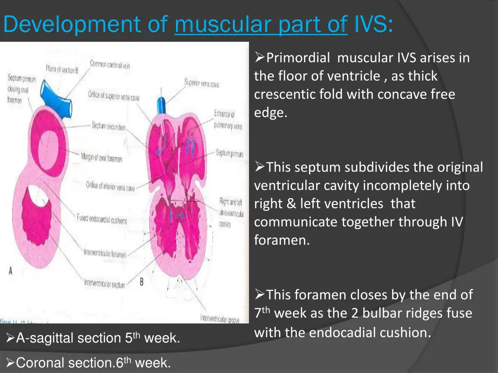 development of muscular part of ivs