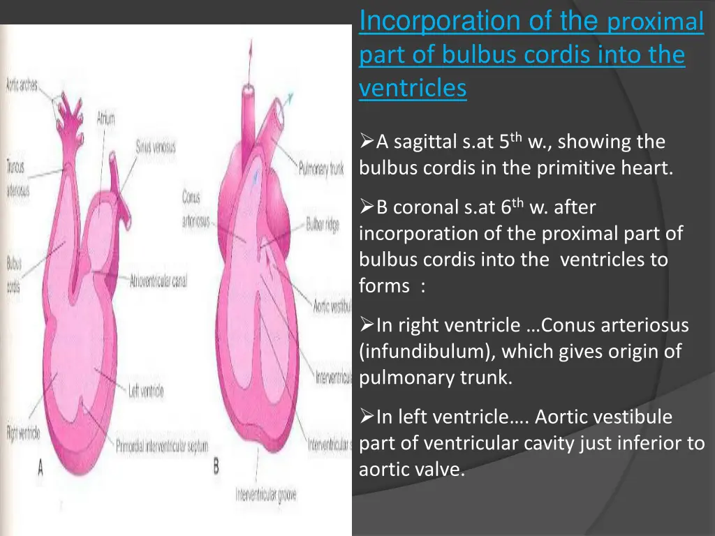 incorporation of the proximal part of bulbus