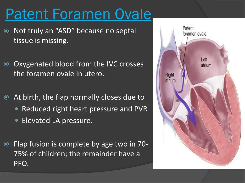 patent foramen ovale