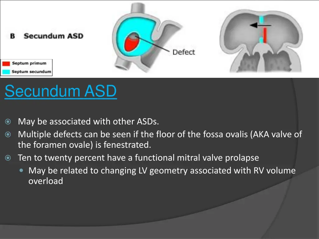 secundum asd 1