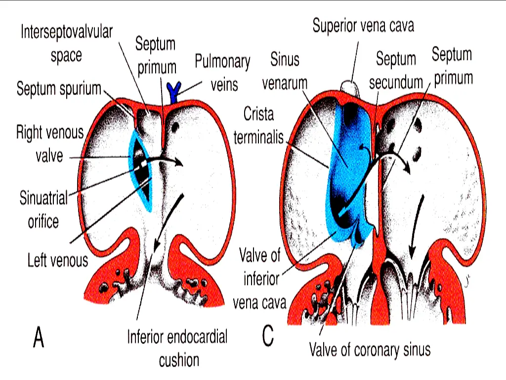 slide20