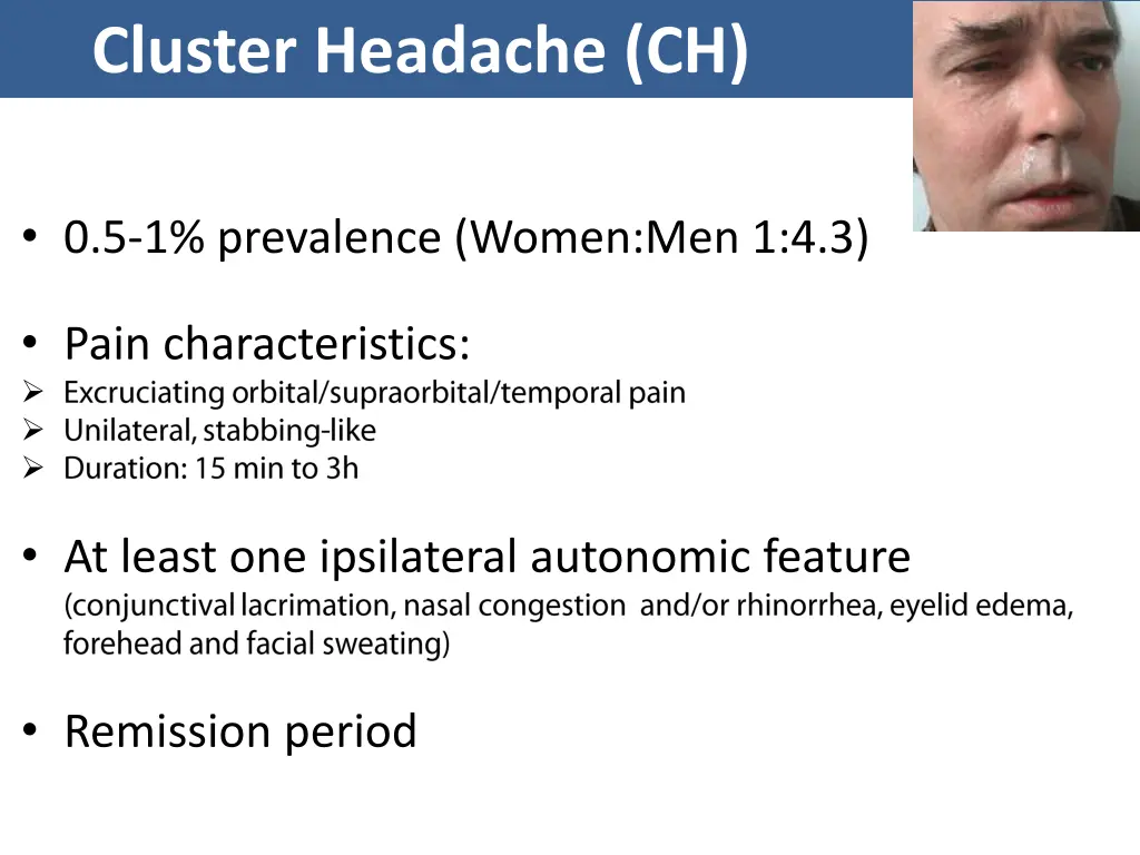 cluster headache ch