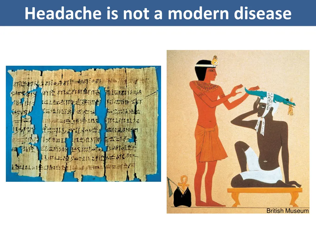 headache is not a modern disease