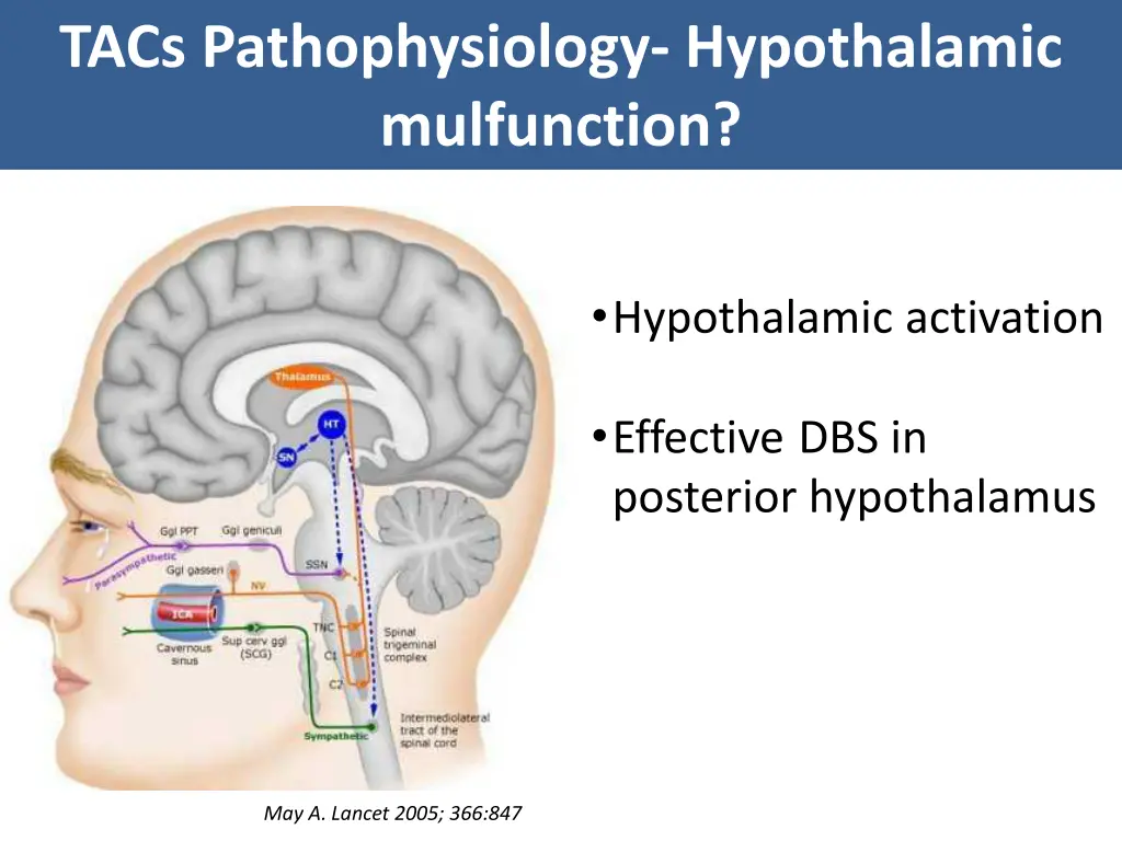 tacs pathophysiology hypothalamic mulfunction