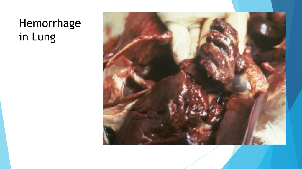 hemorrhage in lung