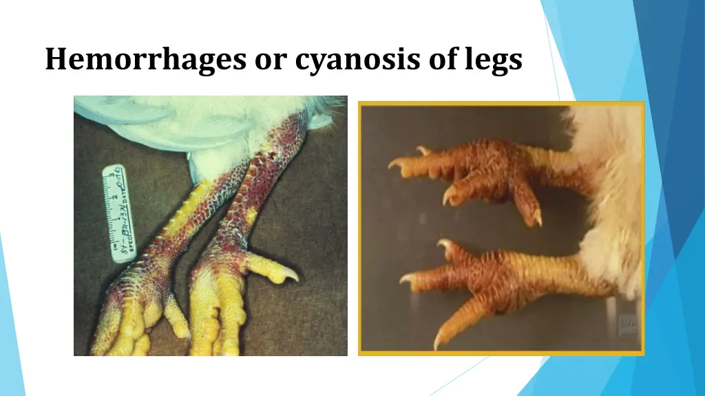 hemorrhages or cyanosis of legs