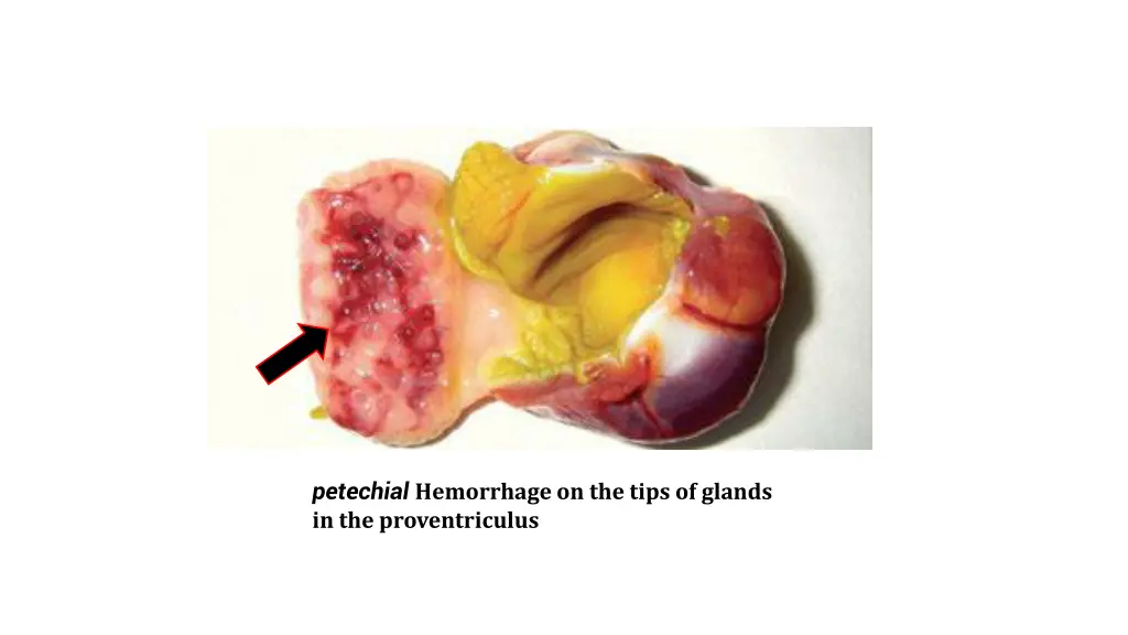 petechial hemorrhage on the tips of glands