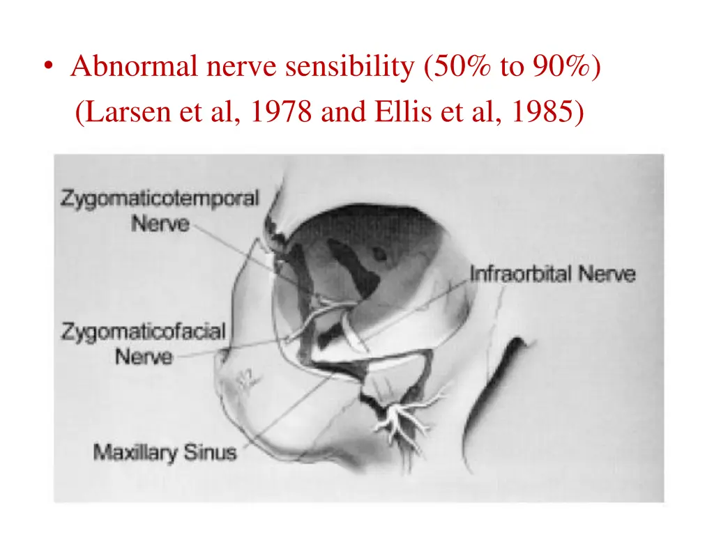 abnormal nerve sensibility 50 to 90 larsen