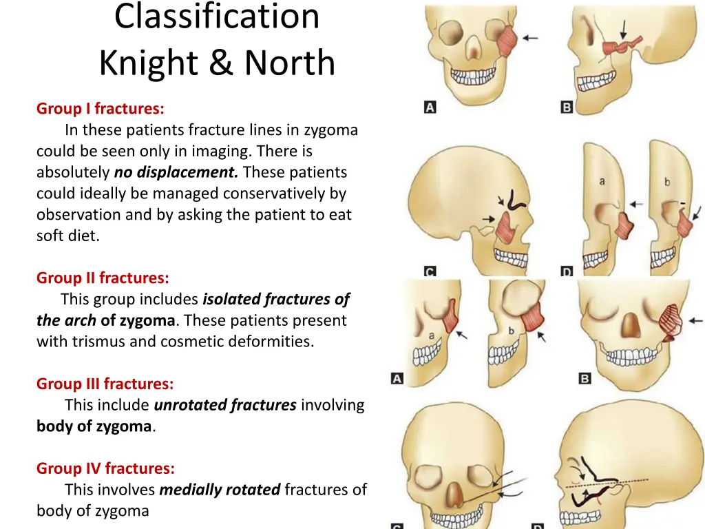 classification knight north