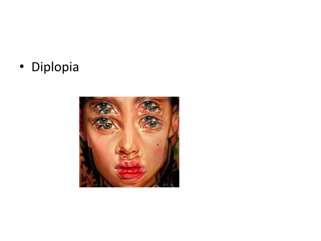 diplopia