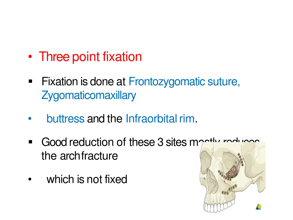 three point fixation