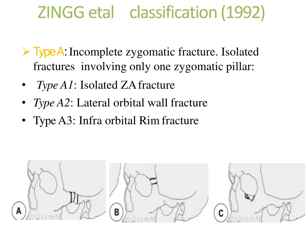 zinggetal classification 1992