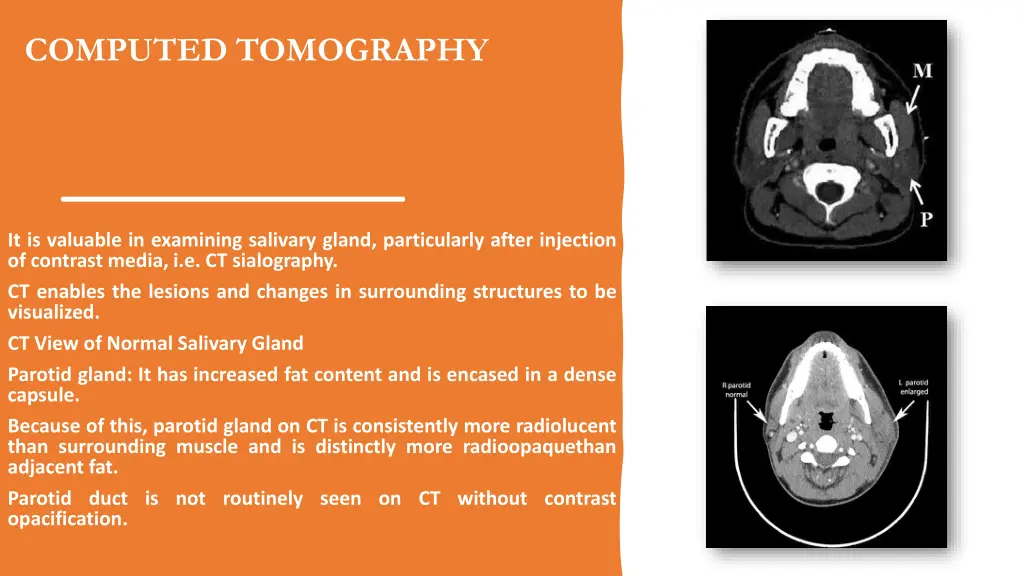 computed tomography