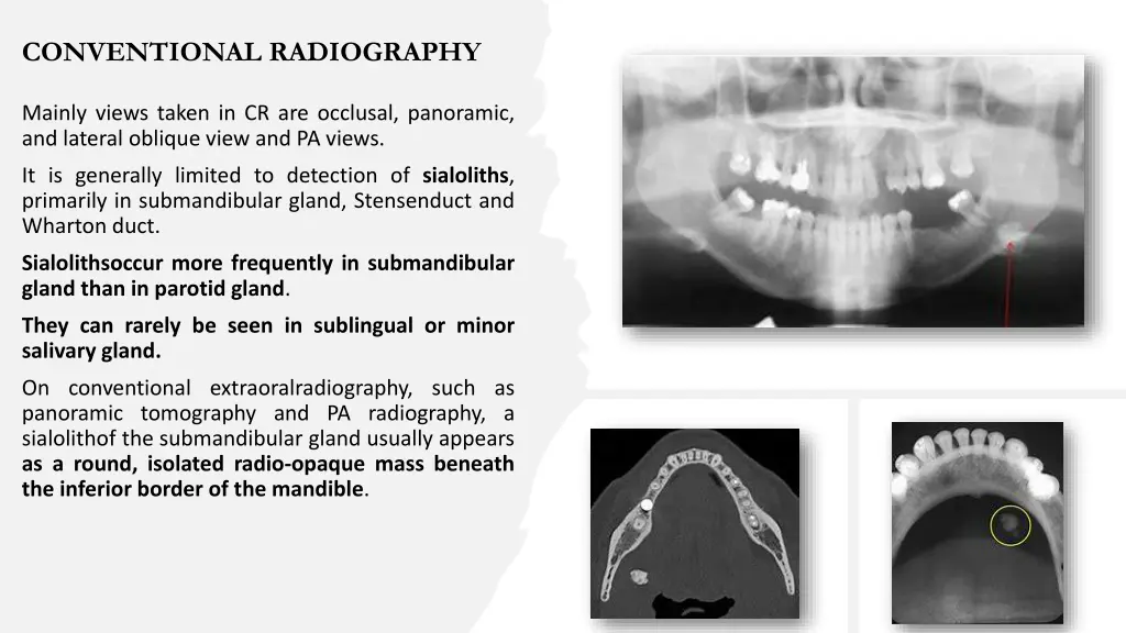 conventional radiography