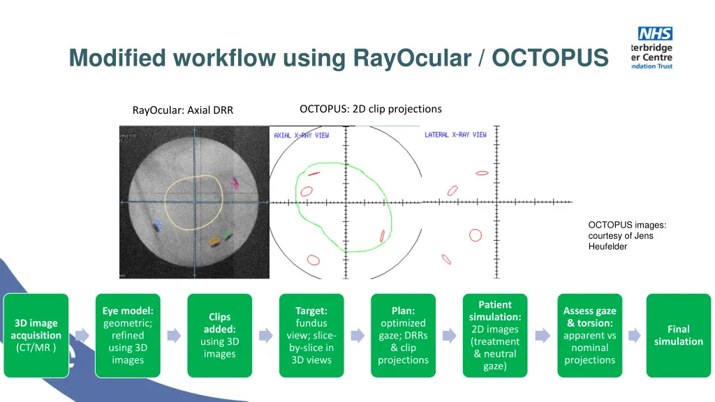 modified workflow using rayocular octopus