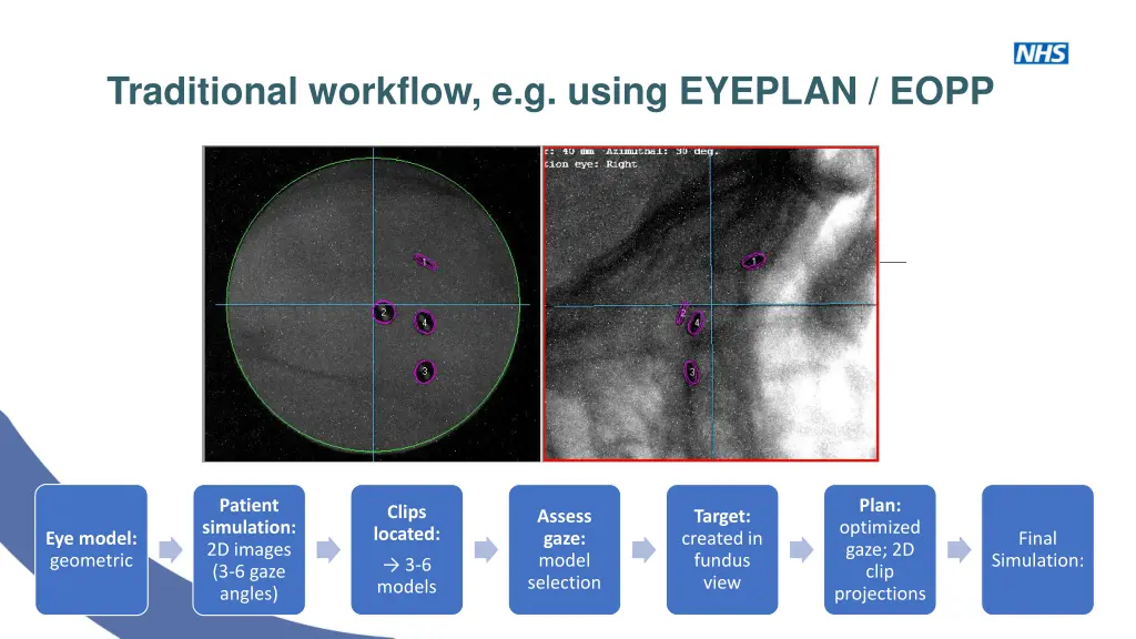 traditional workflow e g using eyeplan eopp