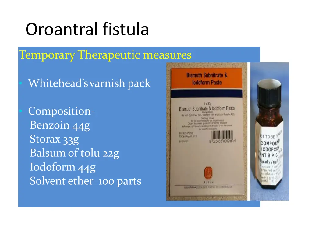 oroantral fistula 5