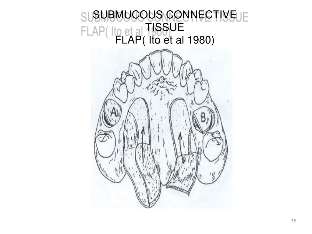 submucous connective tissue flap ito et al 1980