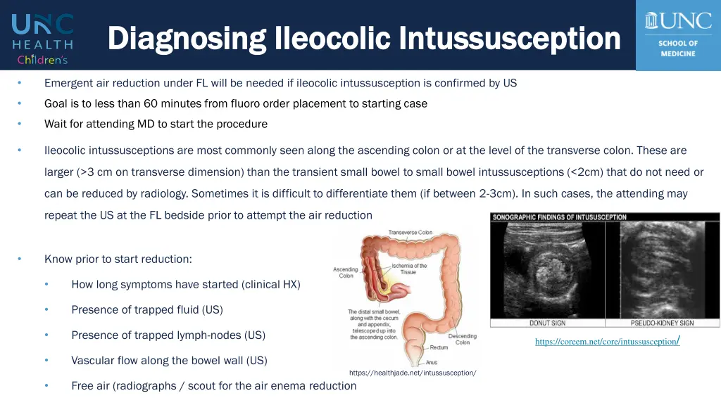 diagnosing ileocolic intussusception diagnosing