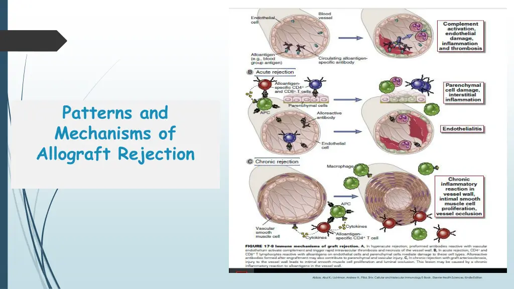 patterns and mechanisms of allograft rejection 1