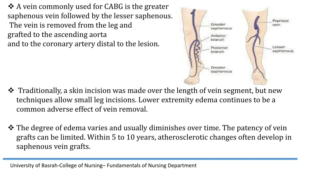 a vein commonly used for cabg is the greater