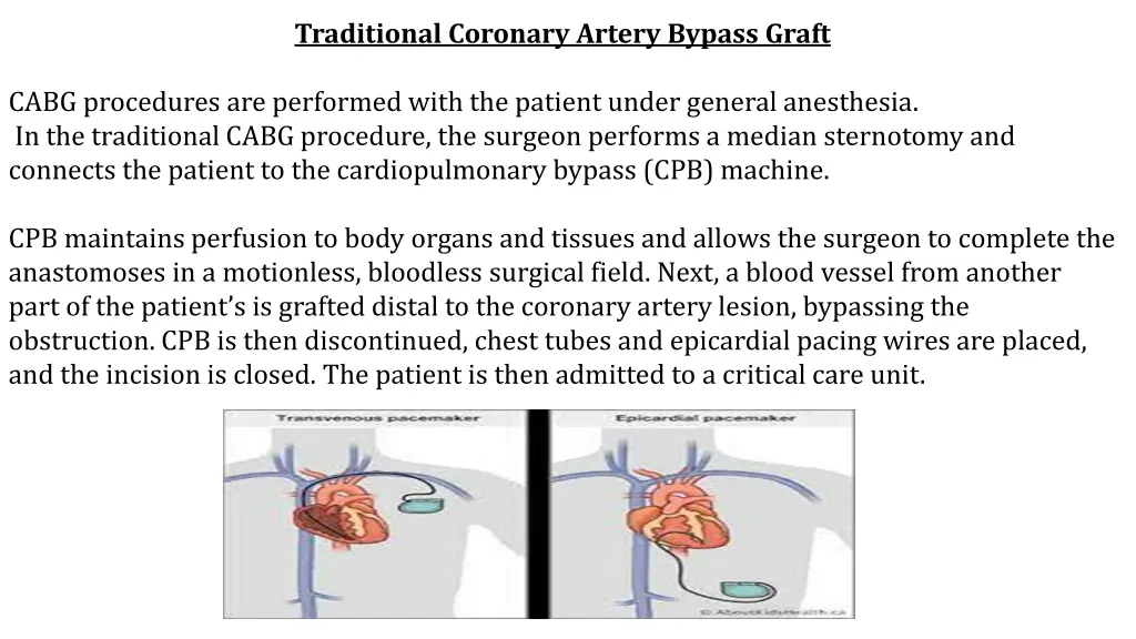 traditional coronary artery bypass graft