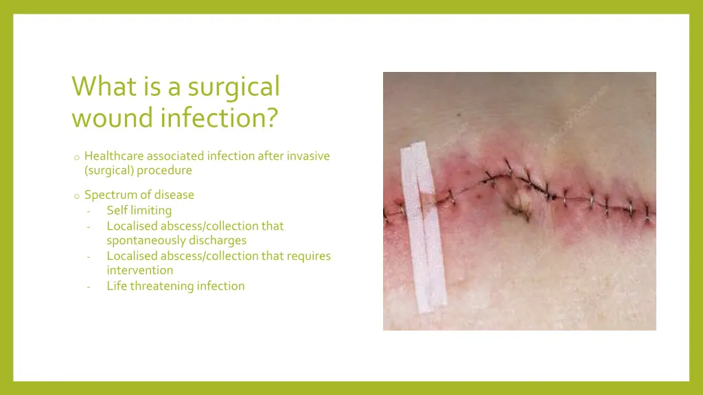 what is a surgical wound infection