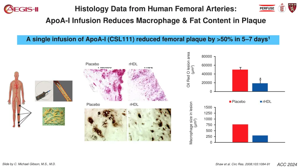 histology data from human femoral arteries apoa