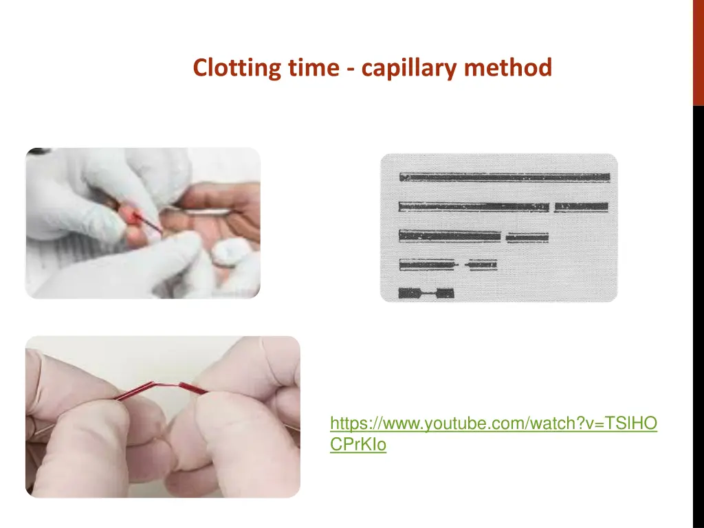 clotting time capillary method 1