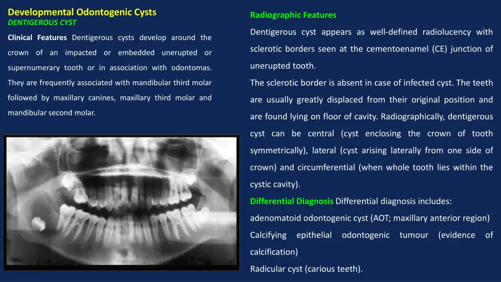 developmental odontogenic cysts