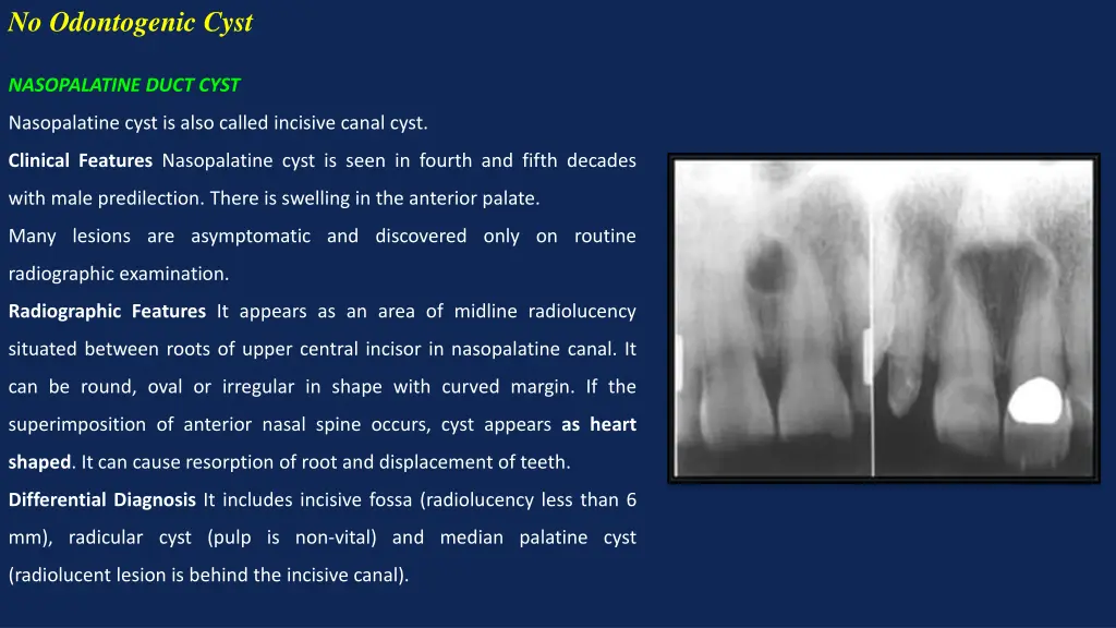 no odontogenic cyst