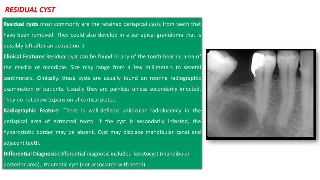 residual cyst