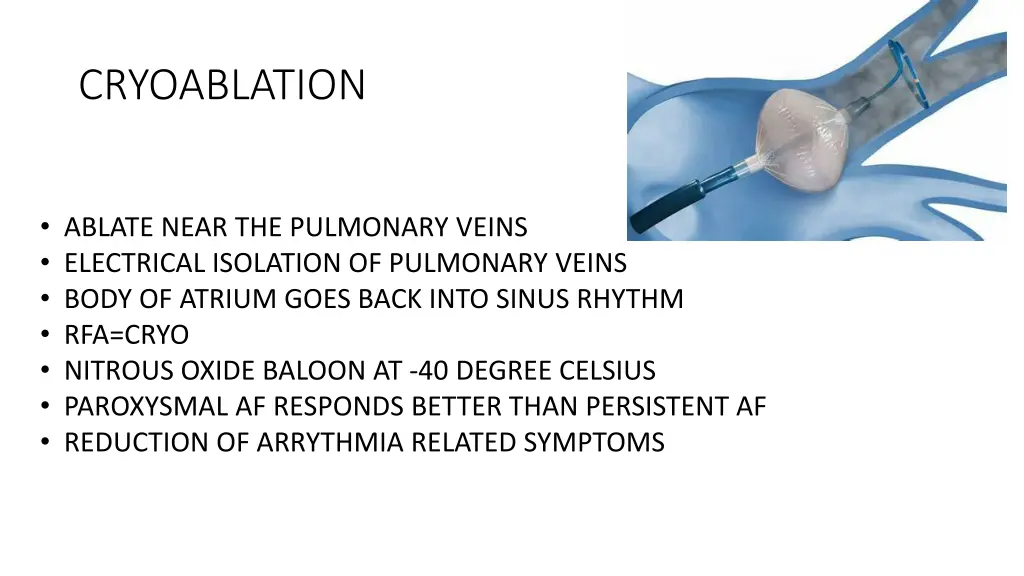 cryoablation