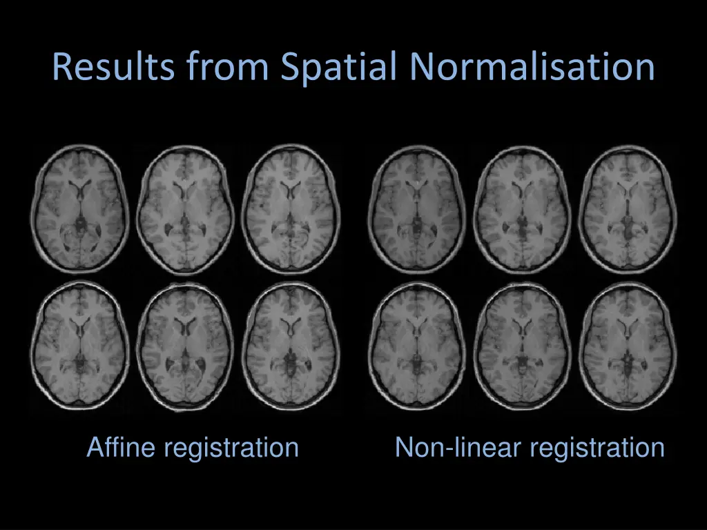 results from spatial normalisation