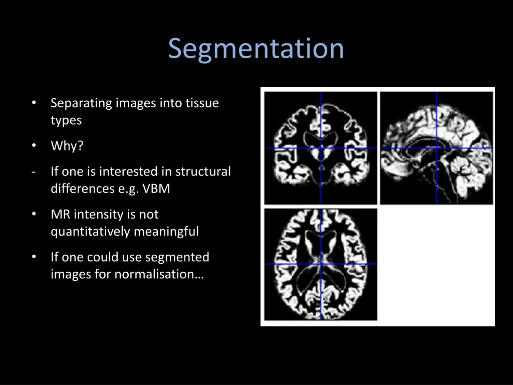 segmentation