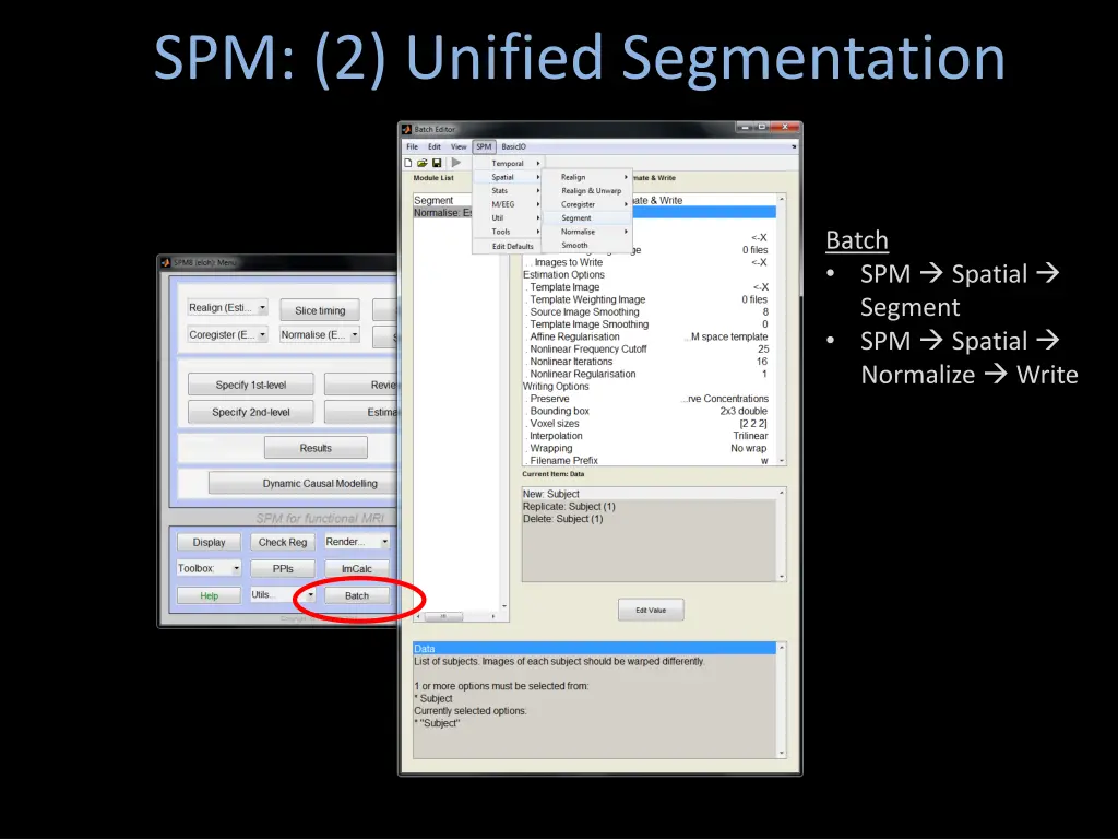 spm 2 unified segmentation