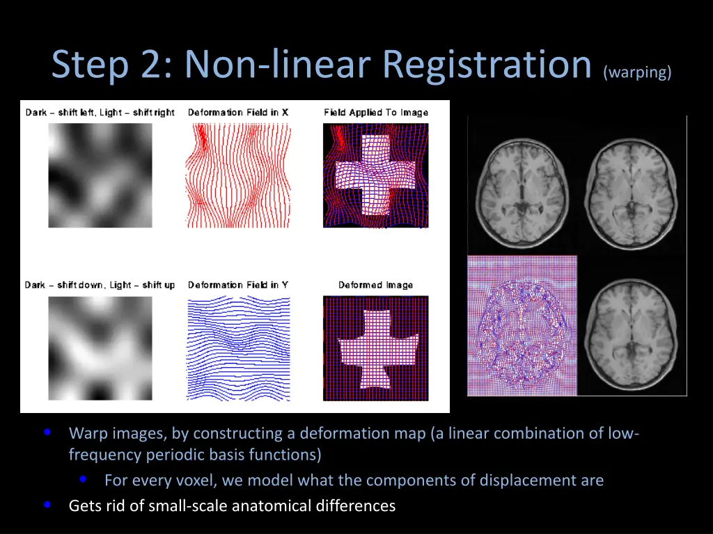 step 2 non linear registration warping